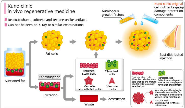 Kuno clinic in vivo regenerative medicine