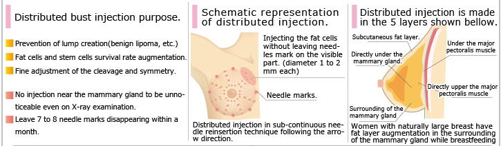 Distributed bust injection purpose.