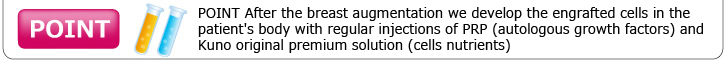 POINT After the breast augmentation we develop the engrafted cells in the patient's body with regular injections of PRP (autologous growth factors) and Kuno original premium solution (cells nutrients)