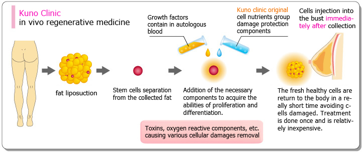 Kuno Clinic in vivo regenerative medicine
