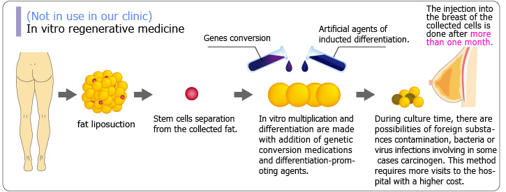 (Not in use in our clinic)In vitro regenerative medicine