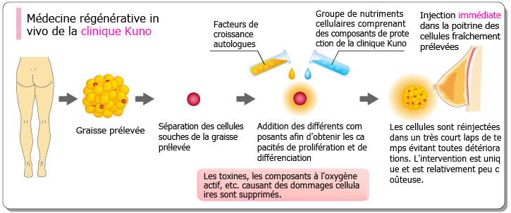 Médecine régénérative in vivo de la clinique Kuno